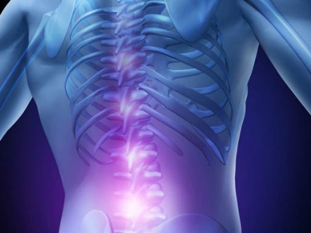 Ortopedia – Chirurgia vertebrale